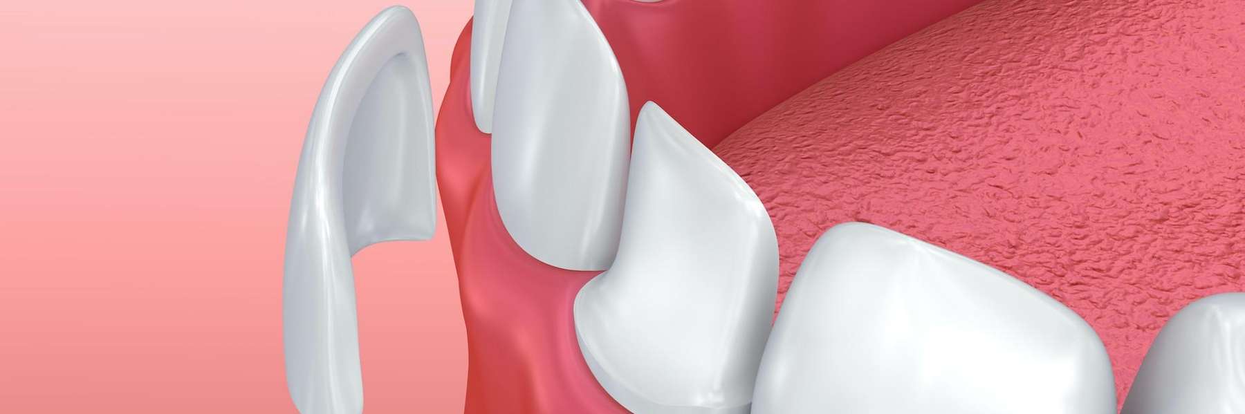 Detailed view of a tooth, emphasizing oral care and the veneers for those with missing teeth.