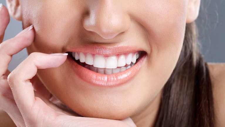  A cheerful woman displaying her teeth, representing the comfort of dental visits in Los Gatos